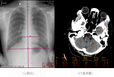 蒲道医学影像信息系统