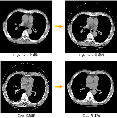 蒲道医学影像信息系统